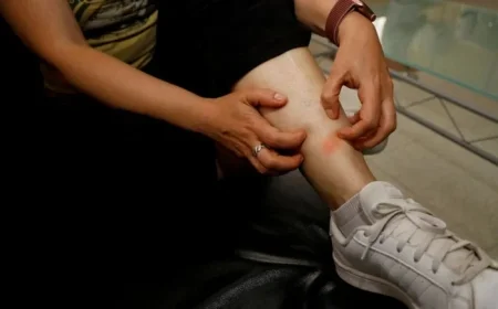 Scabies Outbreak at Chaillots School in Sens Forces Closure Until Monday