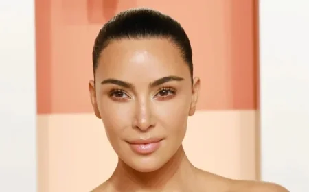 Kim Kardashian’s Health Update Aneurysm Diagnosis Explained
