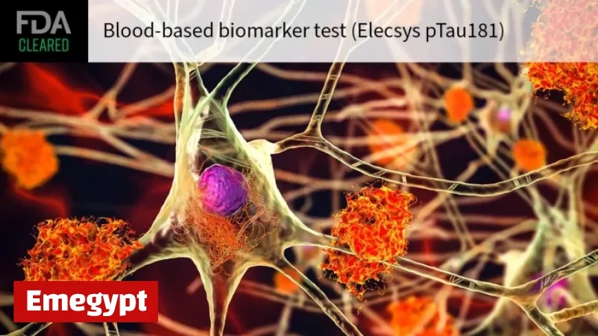 Breakthrough Blood Test Accurately Rules Out Alzheimer’s Disease