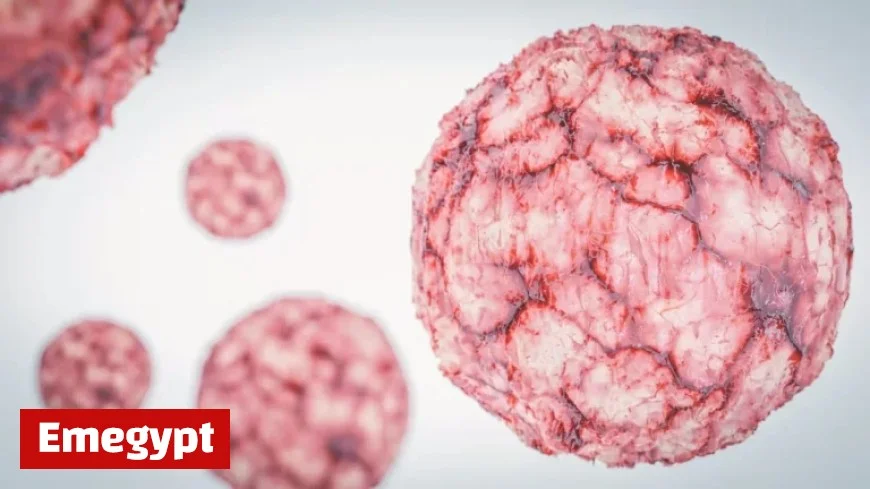 Understanding Mantle Cell Lymphoma: Alexandra Diaz’s Medical Journey Explained