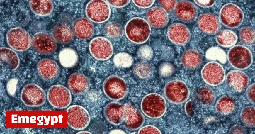 Newly Detected Mpox Strain in L.A. County Could Be More Severe and Contagious