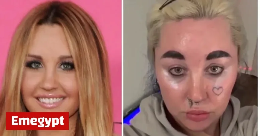 Amanda Bynes Stuns at 39 with Transformation After Weight Loss and Procedures