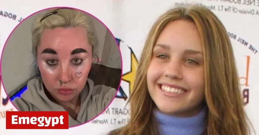 Amanda Bynes Stuns in New Selfie Following Recent Cosmetic Procedure