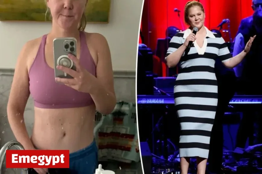 Amy Schumer Showcases Toned Abs Post-Mounjaro: ‘No Filter’