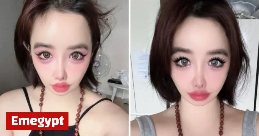 Kpop Star Park Bom Accuses YG Entertainment of Mocking Plastic Surgeries