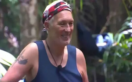 Martin Kemp Reveals Life-Altering Impact of Brain Tumor Surgery