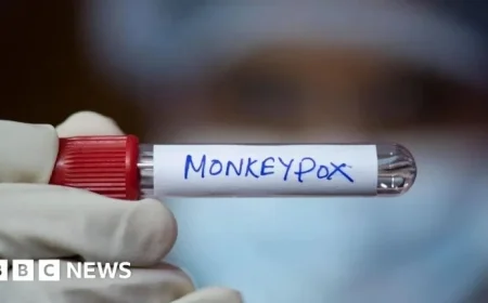 Discovery of new mpox strain in England sparks health discussions
