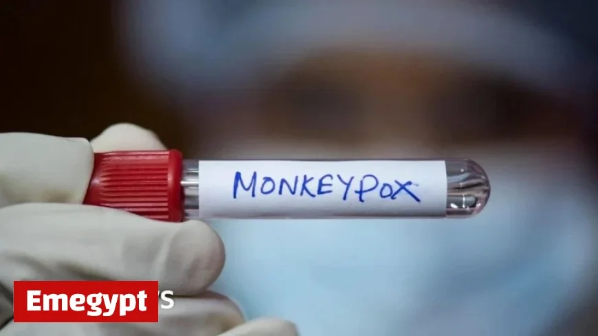 Discovery of new mpox strain in England sparks health discussions